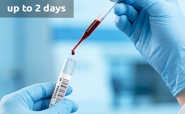 how long does thc stay in blood